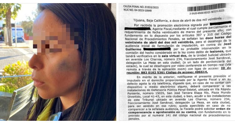 DENUNCIAN A LÍDER DE LOS BURÓCRATAS POR LESIONAR A UNA MUJER